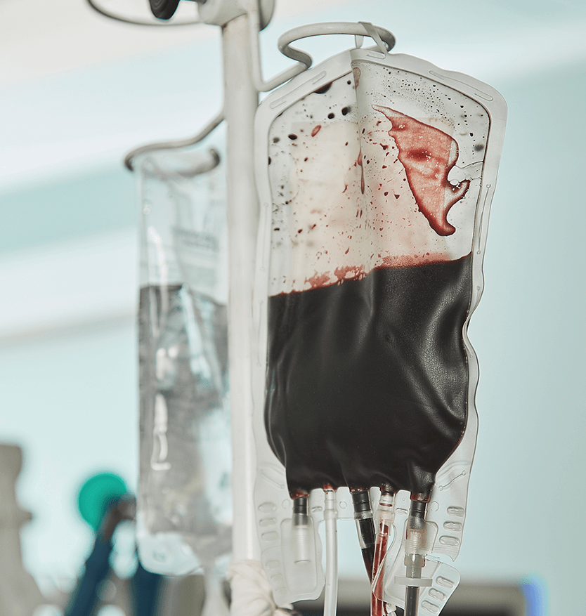 hepatitis c sintomas en la mujer